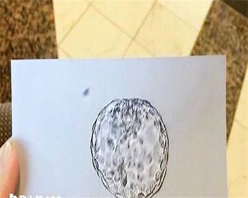 试管助孕成功率